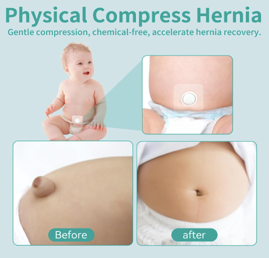 Baby Belly Navel Patches